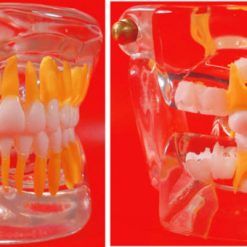 Macro Modelo Dentição Mista em Acrílico Transparente