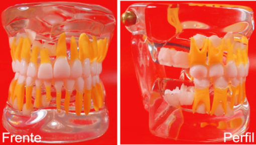 Macro Modelo Dentição Mista em Acrílico Transparente